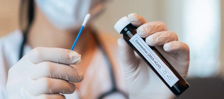 Weak COVID-19 Testing Could Worsen the Pandemic in Latam